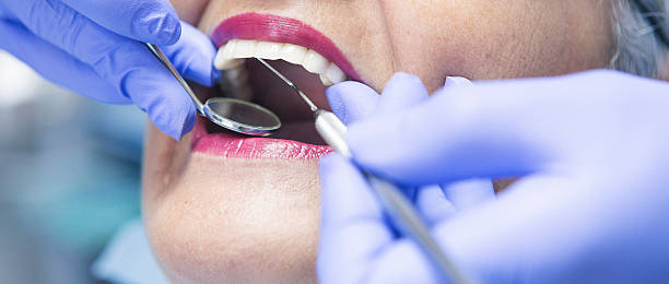 Best Emergency Wisdom Teeth Removal in Coyne Center, IL